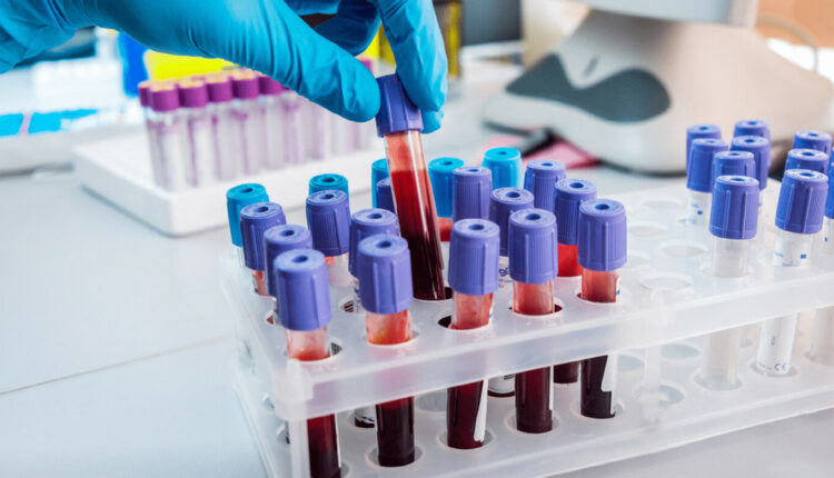 مراکز آزمایش ازدواج